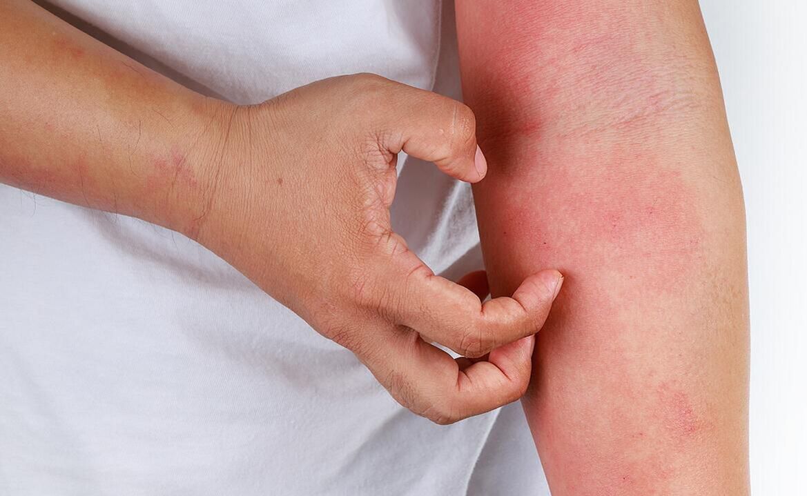 posibile complicații de la utilizarea sifonului